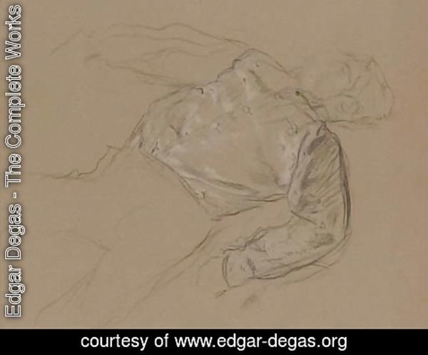 Edgar Degas - Jockey blesse